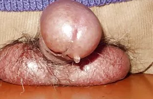 XXX Beristirahat di taman sex sedarah ibu secara sanggama